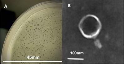 Biological characteristics and genomic analysis of a novel Vibrio parahaemolyticus phage phiTY18 isolated from the coastal water of Xiamen China